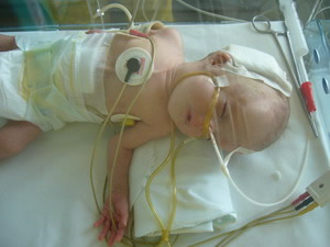 Hydrocelphalus Program Bulgaria